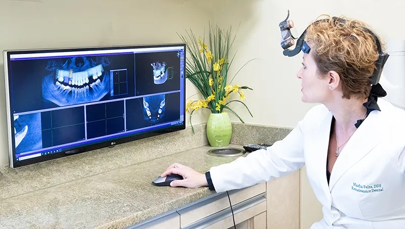 CBCT