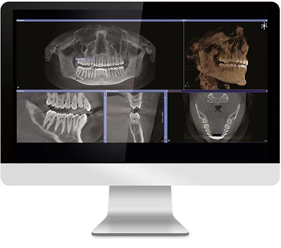Midtown East Dental Implants Midtown East Dental Implants